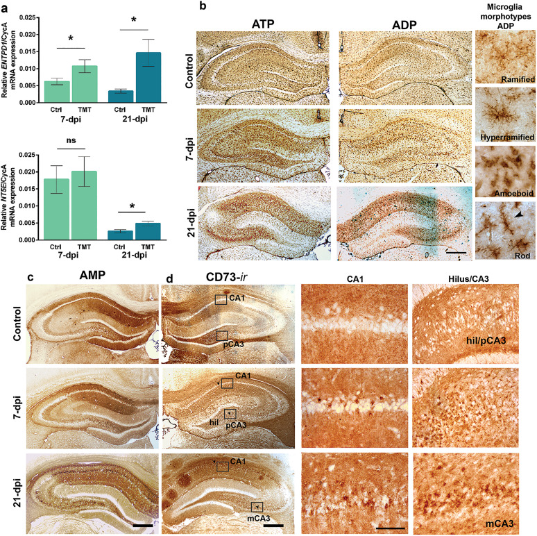 Microglial- and Astrocyte-Specific Expression of Purinergic Signaling Components and Inflammatory Mediators in the Rat Hippocampus During Trimethyltin-Induced Neurodegeneration.