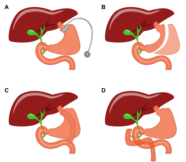 Improving glucose and lipids metabolism: drug development based on bile acid related targets.