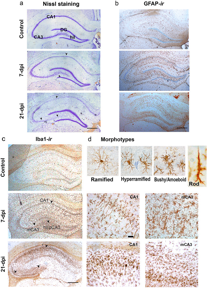 Microglial- and Astrocyte-Specific Expression of Purinergic Signaling Components and Inflammatory Mediators in the Rat Hippocampus During Trimethyltin-Induced Neurodegeneration.