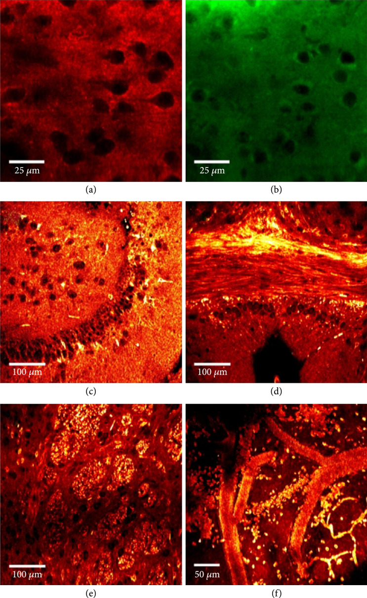 Recent Advancements in Optical Harmonic Generation Microscopy: Applications and Perspectives.