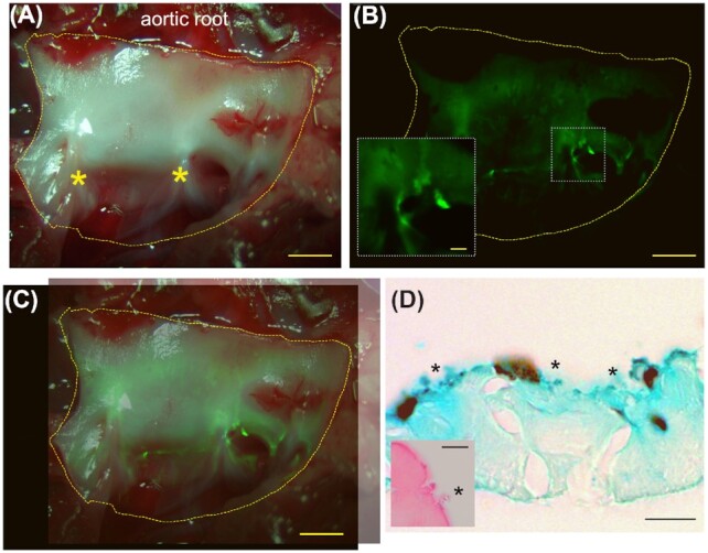 <i>Enterococcus faecalis</i> colonizes and forms persistent biofilm microcolonies on undamaged endothelial surfaces in a rabbit endovascular infection model.