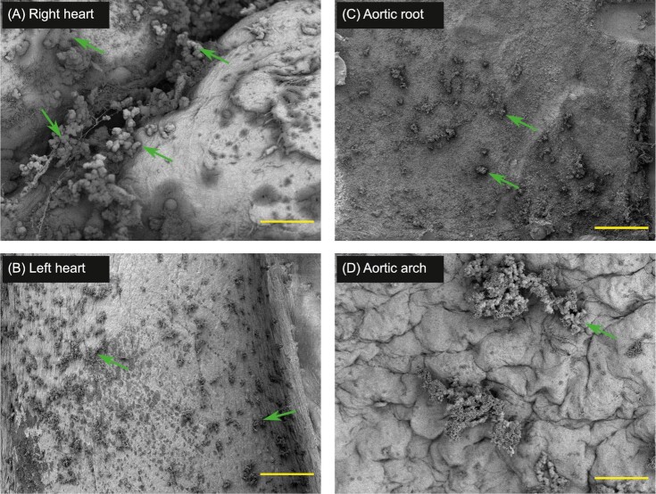 <i>Enterococcus faecalis</i> colonizes and forms persistent biofilm microcolonies on undamaged endothelial surfaces in a rabbit endovascular infection model.