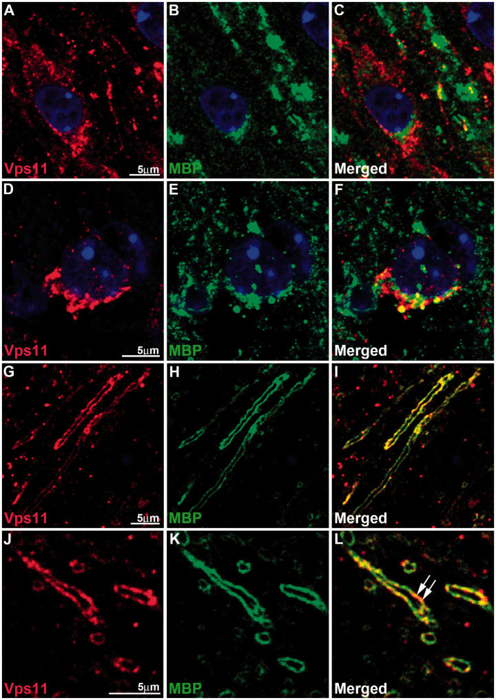 Characterization of the Expression of Vacuolar Protein Sorting 11 (Vps11) in Mammalian Oligodendrocytes.