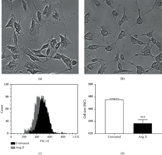 Angiotensin II Induces Differentiation of Human Neuroblastoma Cells by Increasing MAP2 and ROS Levels.