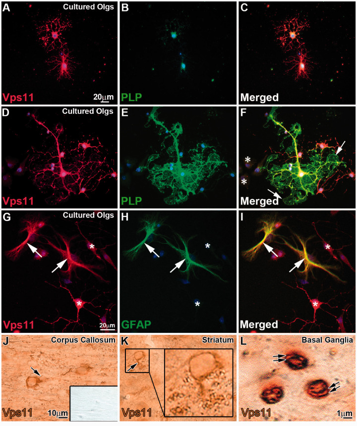 Characterization of the Expression of Vacuolar Protein Sorting 11 (Vps11) in Mammalian Oligodendrocytes.