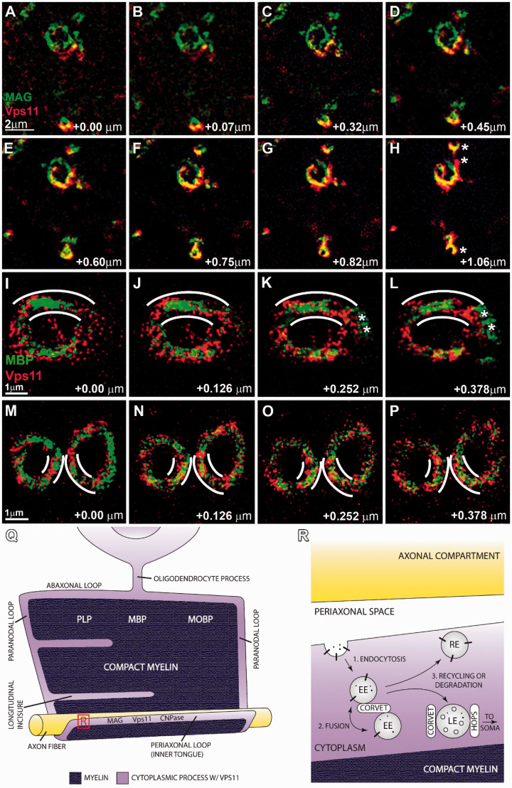 Characterization of the Expression of Vacuolar Protein Sorting 11 (Vps11) in Mammalian Oligodendrocytes.