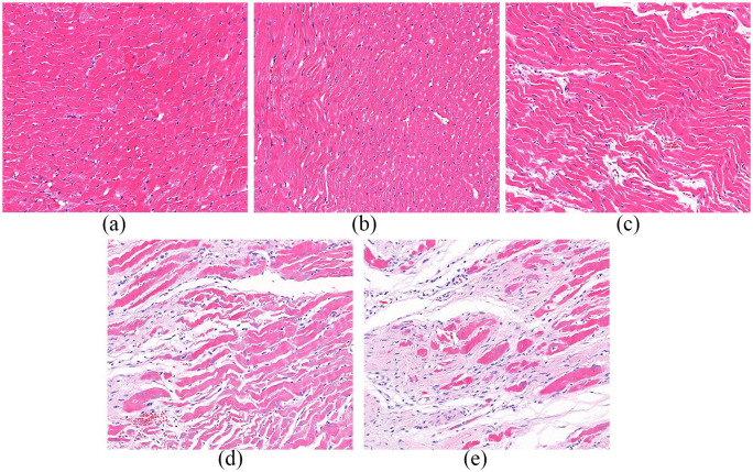 PM2.5 inducing myocardial fibrosis mediated by Ang II/ERK1/2/TGF-β<sub>1</sub> signaling pathway in mice model.