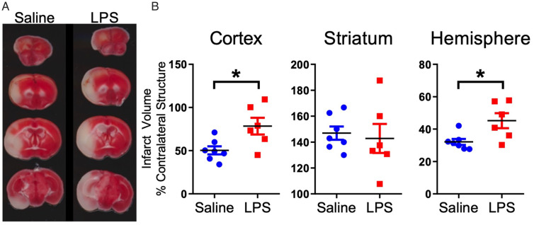 Intermittent Lipopolysaccharide Exposure Significantly Increases Cortical Infarct Size and Impairs Autophagy.