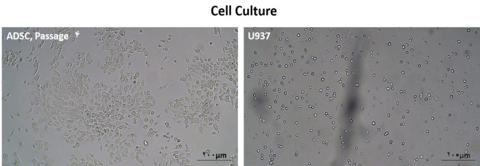 Induction of Apoptosis in the U937 Cell Line Co-cultured with Adipose-derived Stem Cells Secreting Bone Morphogenetic Protein-4.