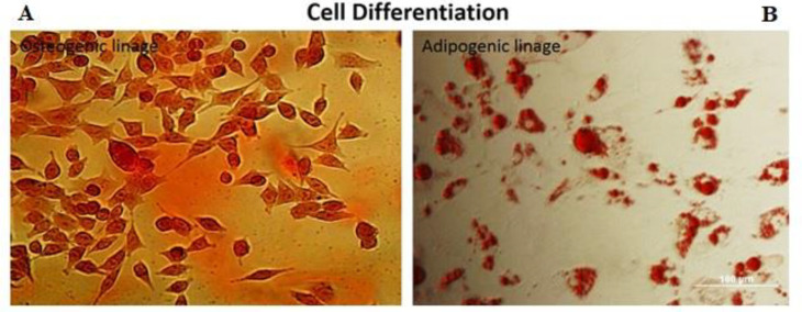 Induction of Apoptosis in the U937 Cell Line Co-cultured with Adipose-derived Stem Cells Secreting Bone Morphogenetic Protein-4.