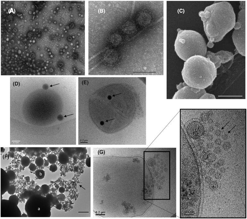 Extracellular membrane vesicles and nanotubes in Archaea.