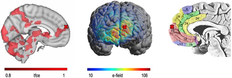 Understanding the Neurocomputational Mechanisms of Antidepressant Placebo Effects.