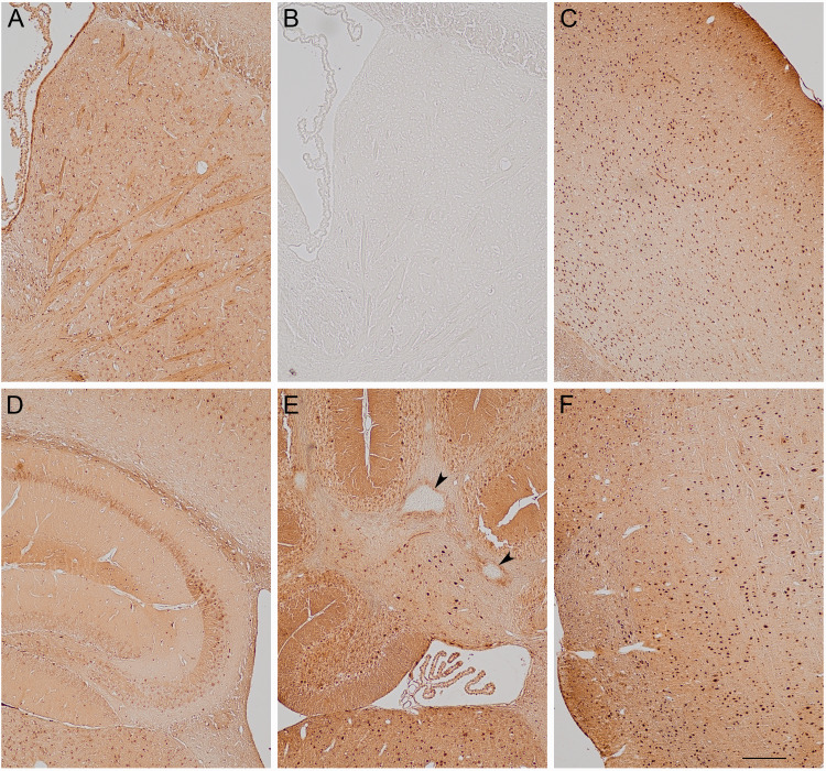 A Simplified Method for the Histochemical Detection of Iron in Paraffin Sections: Intracellular Iron Deposits in Central Nervous System Tissue.