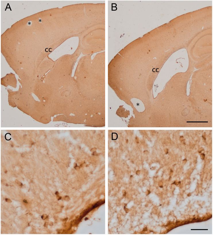 A Simplified Method for the Histochemical Detection of Iron in Paraffin Sections: Intracellular Iron Deposits in Central Nervous System Tissue.