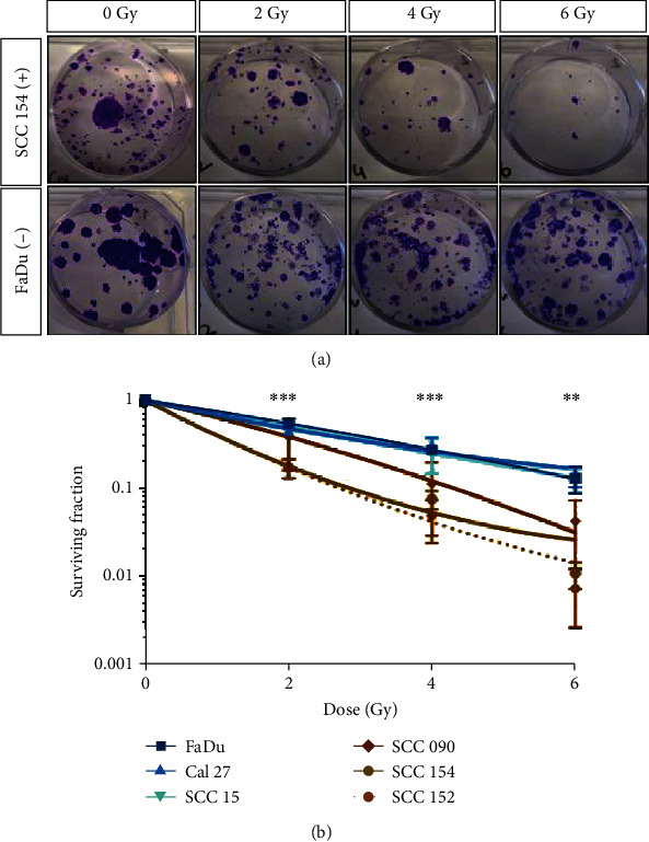 [<sup>18</sup>F]PARPi Imaging Is Not Affected by HPV Status In Vitro.