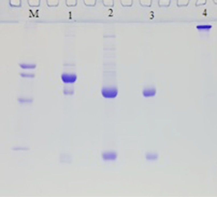 Efficient conjugation of anti-HBsAg antibody to modified core-shell magnetic nanoparticles (Fe<sub>3</sub>O<sub>4</sub>@SiO<sub>2</sub>/NH<sub>2</sub>).