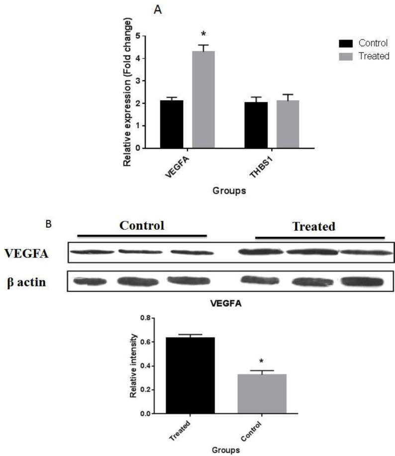 Oral Contraceptive Steroids Promote Papillary Thyroid Cancer Metastasis by Targeting Angiogenesis and Epithelial-Mesenchymal Transition.