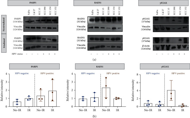 [<sup>18</sup>F]PARPi Imaging Is Not Affected by HPV Status In Vitro.