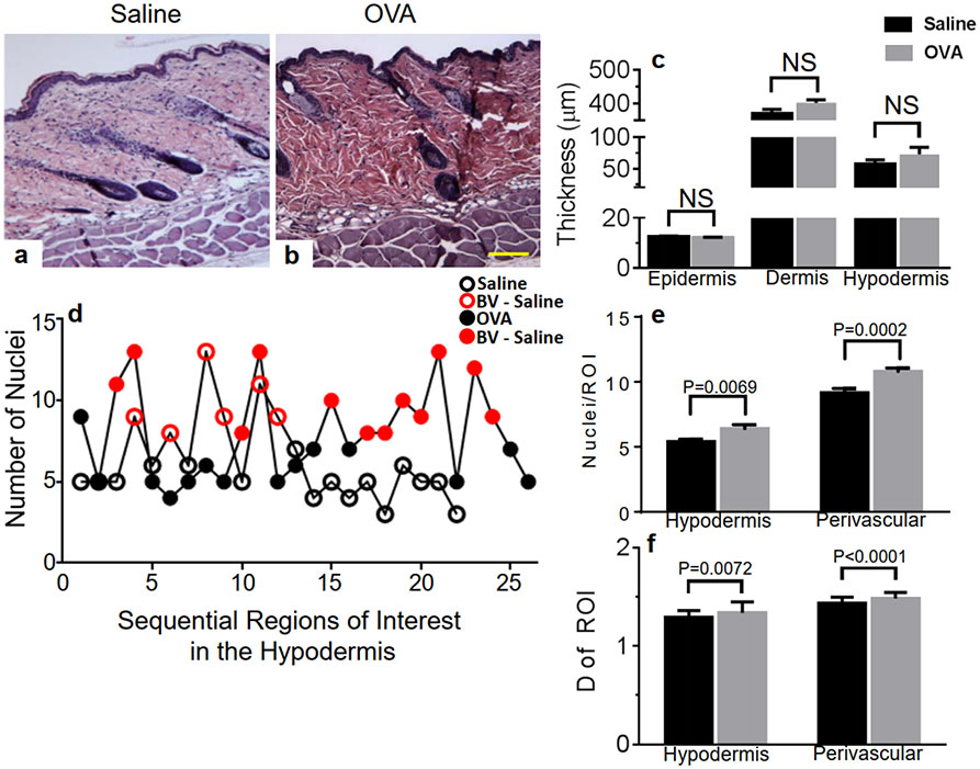 The mast cell/S1P axis is not linked to pre-lesional male skin remodeling in a mouse model of eczema.