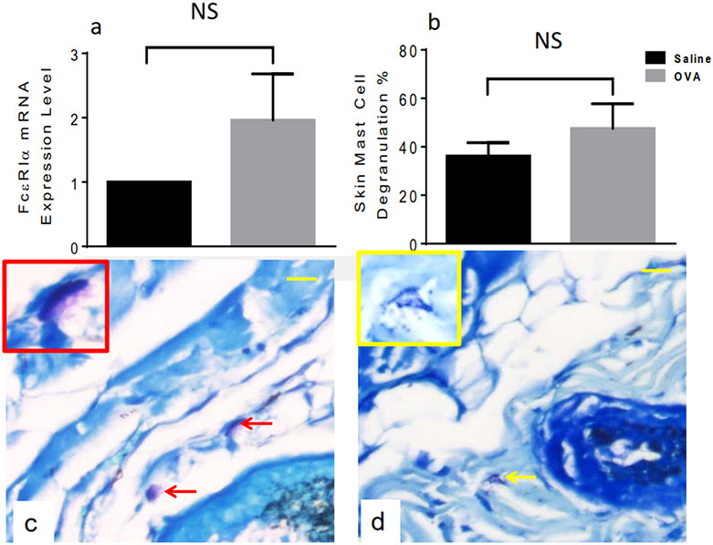 The mast cell/S1P axis is not linked to pre-lesional male skin remodeling in a mouse model of eczema.