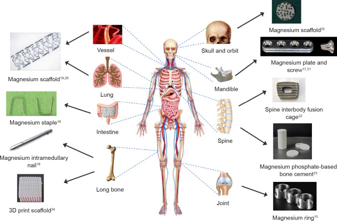 Magnesium-based materials in orthopaedics: material properties and animal models.