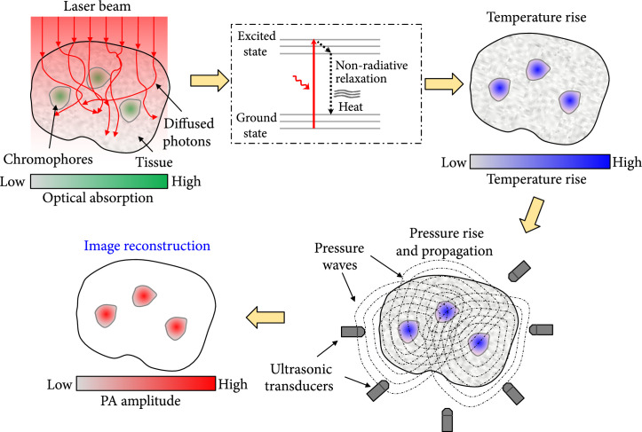 Recent advances in photoacoustic tomography.