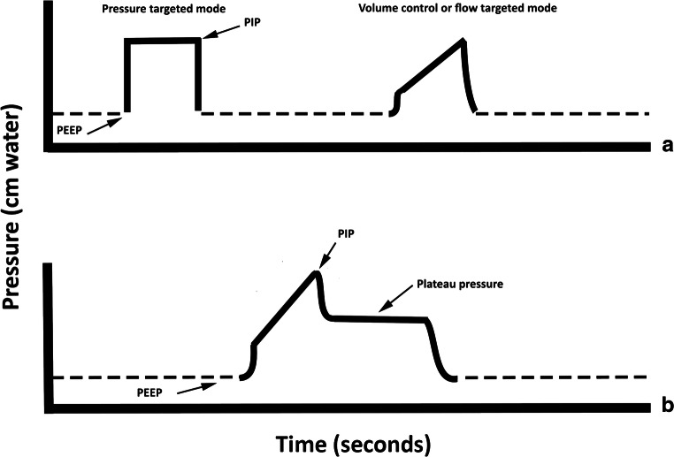 The Basics of Ventilator Waveforms.