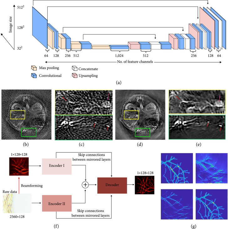 Recent advances in photoacoustic tomography.