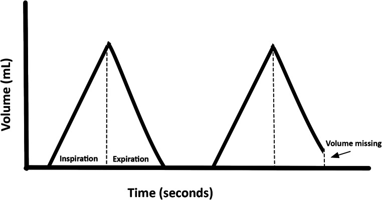 The Basics of Ventilator Waveforms.