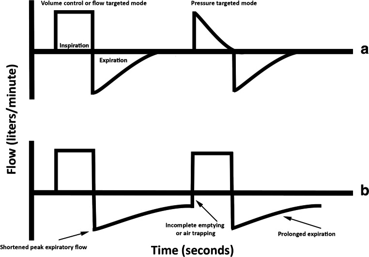 The Basics of Ventilator Waveforms.