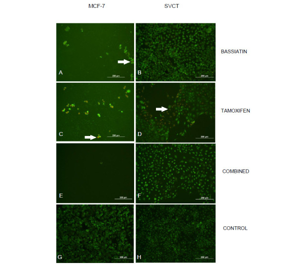 <i>In vitro</i> studies on inhibition capability of fungal-sourced bassiatin versus tamoxifen against ERα, EGFR and VEGFR on breast cancer cells.