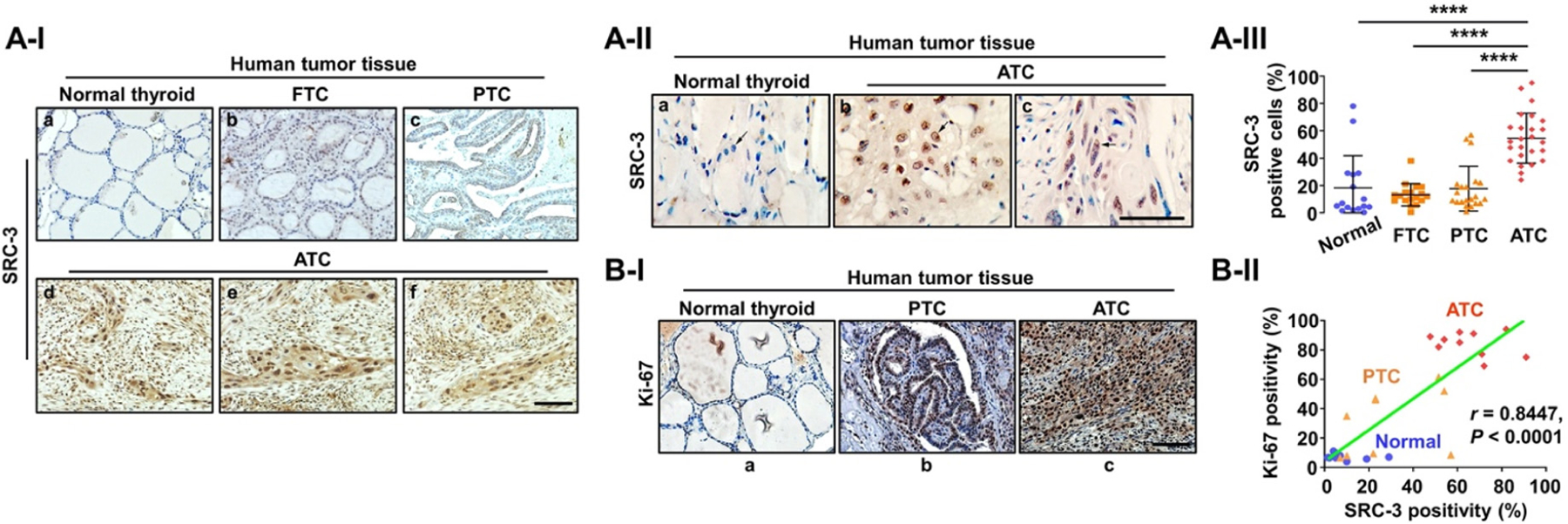 Targeting transcriptional regulators for treatment of anaplastic thyroid cancer.