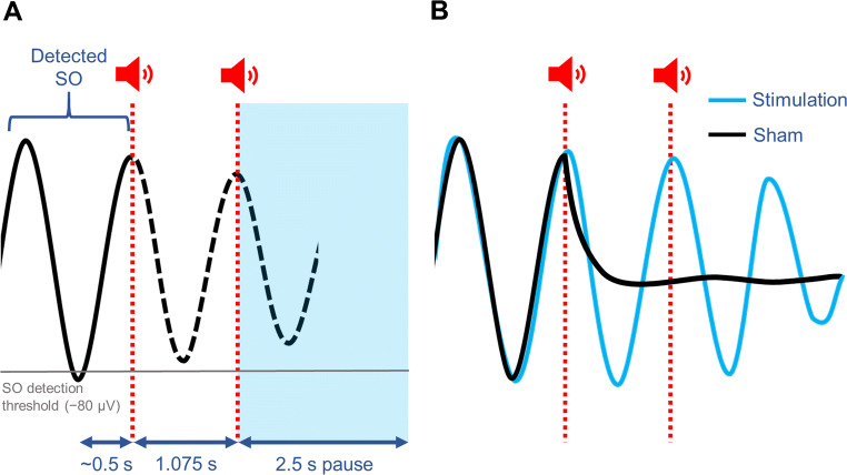 Sounding It Out: Auditory Stimulation and Overnight Memory Processing.