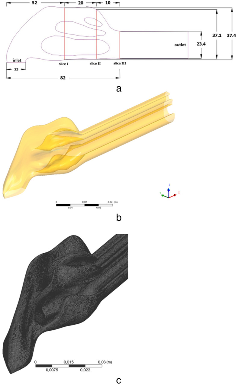 A numerical simulation of air flow in the human respiratory system for various environmental conditions.