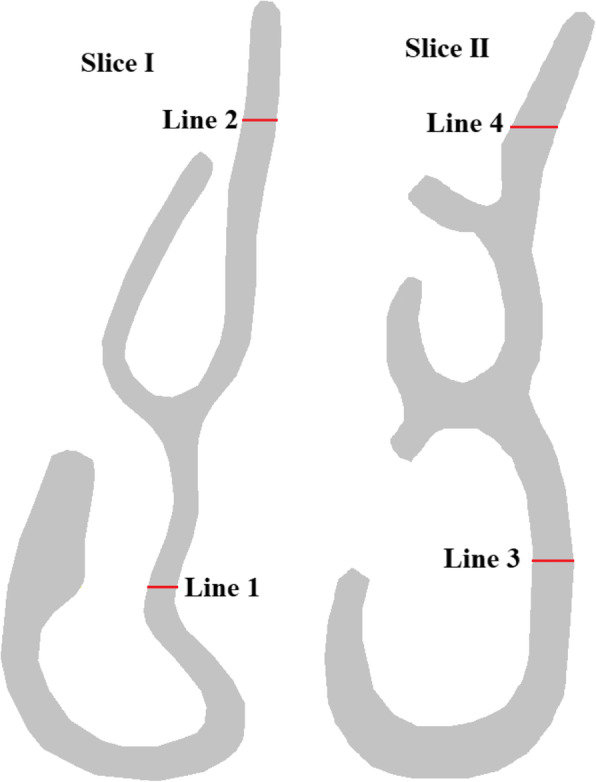 A numerical simulation of air flow in the human respiratory system for various environmental conditions.