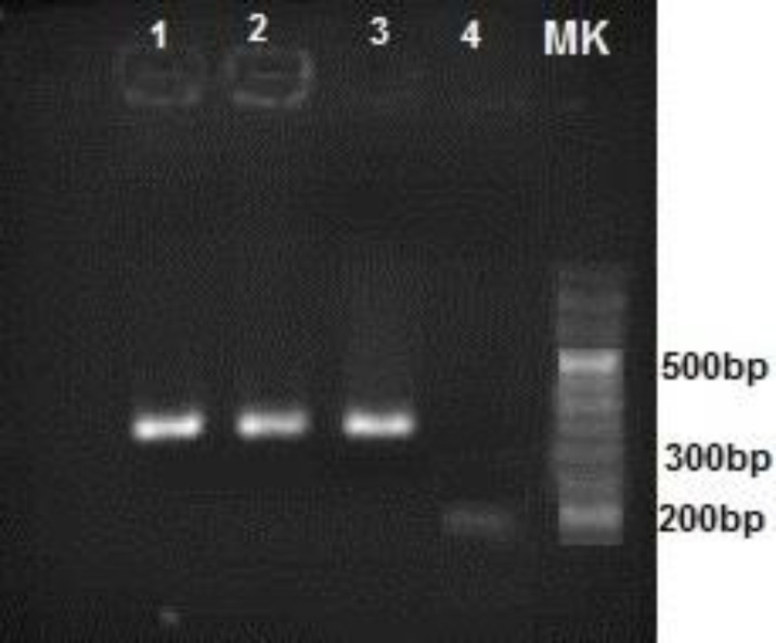 Modulation of mRNA Expression of Monoacylglycerol Lipase, Diacylglycerol Lipase and Cannabinoid Receptor-1 in Mice Experimentally Infected with <i>T. gondii</i>.