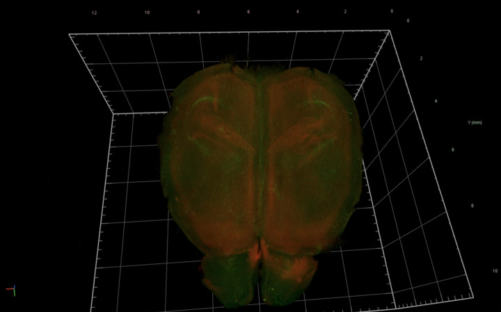 Neuroprotective function of microglia in the developing brain.