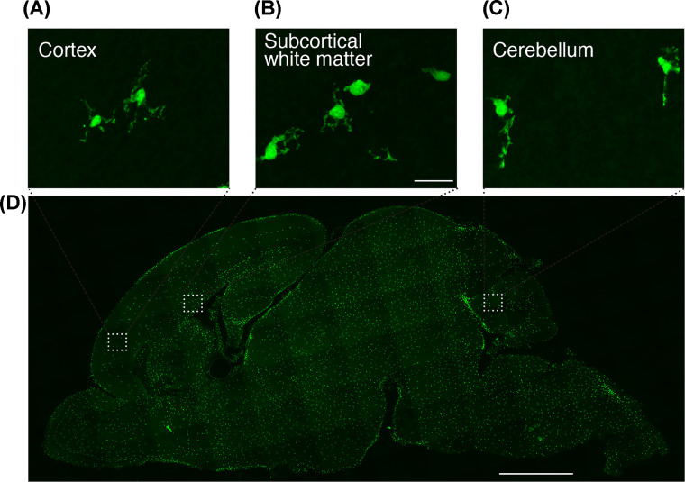 Neuroprotective function of microglia in the developing brain.