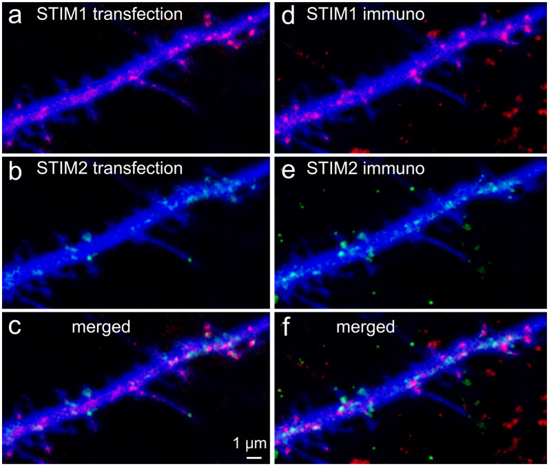 Calcium Sensors STIM1 and STIM2 Regulate Different Calcium Functions in Cultured Hippocampal Neurons.