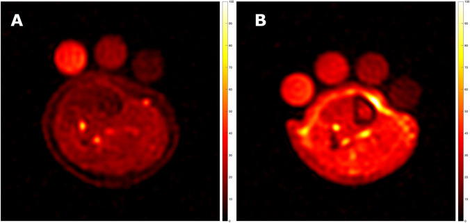 Animal, Human, and <sup>23</sup>Na MRI Imaging Evidence for the Negative Impact of High Dietary Salt in Children.