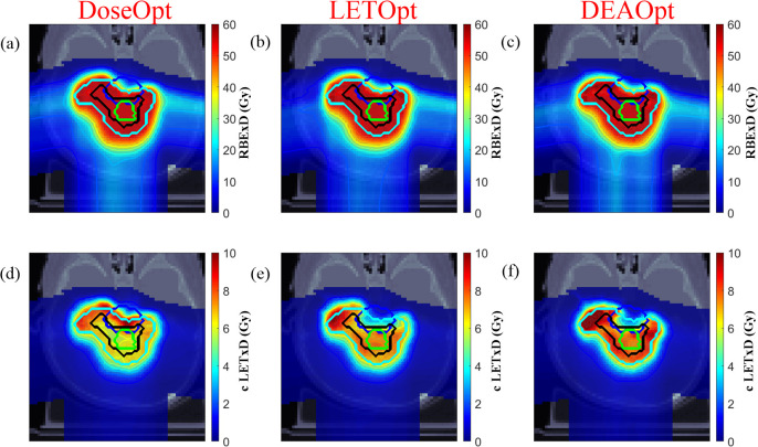 The Biological Basis for Enhanced Effects of Proton Radiation Therapy Relative to Photon Radiation Therapy for Head and Neck Squamous Cell Carcinoma.