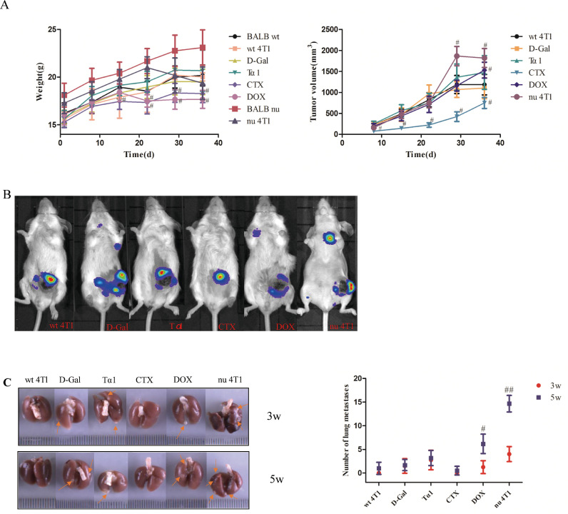 Thymic function affects breast cancer development and metastasis by regulating expression of thymus secretions PTMα and Tβ15b1.