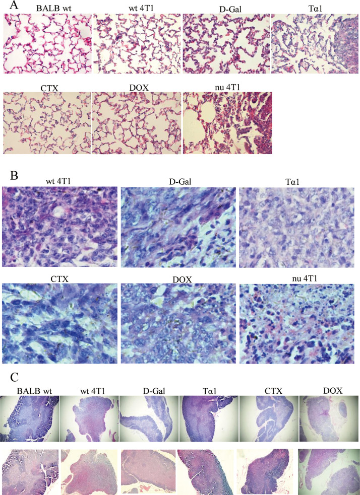 Thymic function affects breast cancer development and metastasis by regulating expression of thymus secretions PTMα and Tβ15b1.