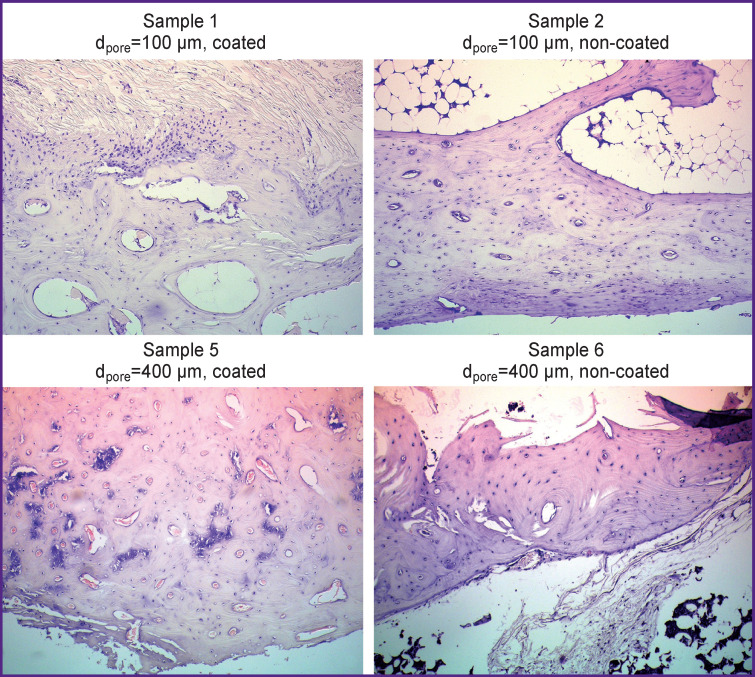 Biocompatibility and Osseointegration of Calcium Phosphate-Coated and Non-Coated Titanium Implants with Various Porosities.