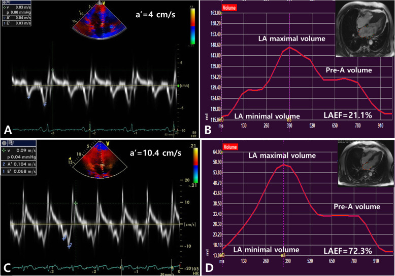 Contribution of sarcomere gene mutations to left atrial function in patients with hypertrophic cardiomyopathy.