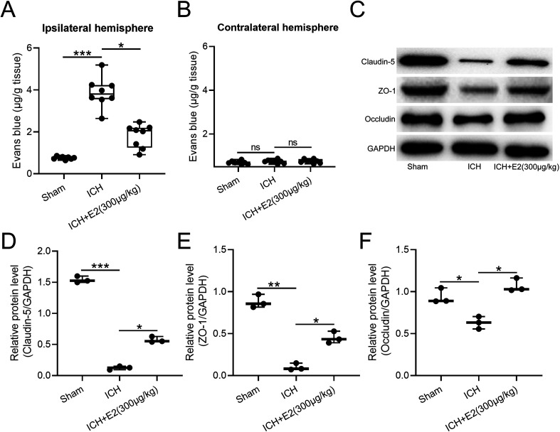 17β-Estradiol Attenuates Intracerebral Hemorrhage-Induced Blood-Brain Barrier Injury and Oxidative Stress Through SRC3-Mediated PI3K/Akt Signaling Pathway in a Mouse Model.