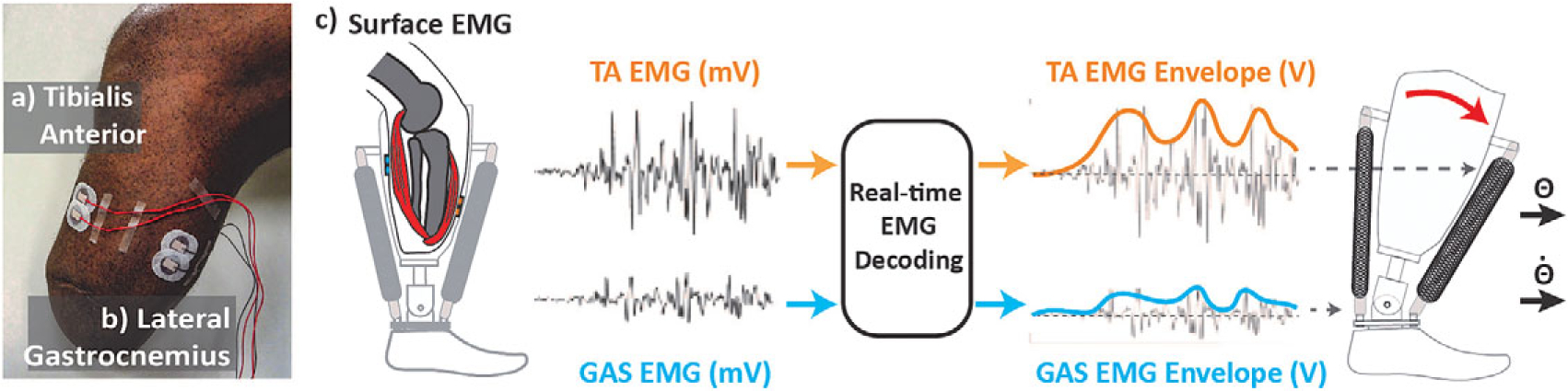 Direct continuous electromyographic control of a powered prosthetic ankle for improved postural control after guided physical training: A case study.