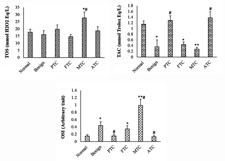 Comparing Oxidative Stress Status Among Iranian Males and Females with Malignant and Non-malignant Thyroid Nodules.