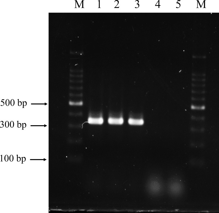 Isolation, identification, and impact on intestinal barrier integrity of <i>Lactiplantibacillus plantarum</i> from fresh tea leaves <i>(Camellia sinensis)</i>.