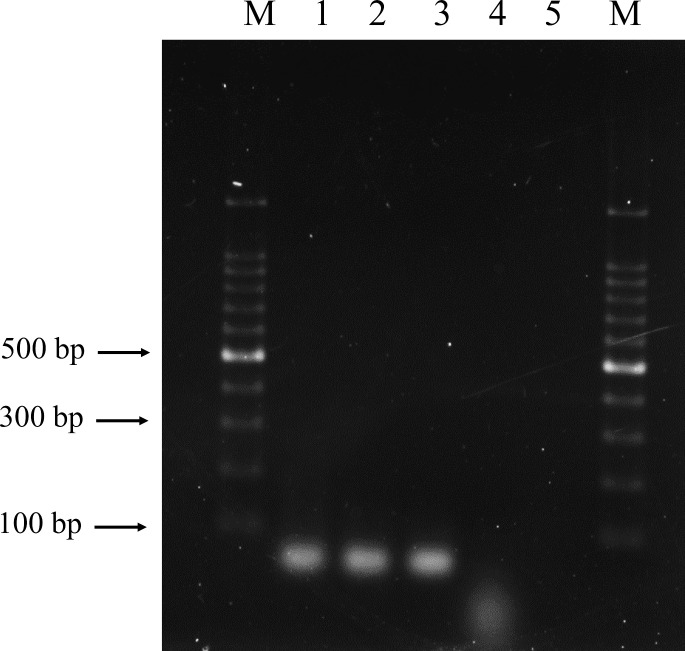 Isolation, identification, and impact on intestinal barrier integrity of <i>Lactiplantibacillus plantarum</i> from fresh tea leaves <i>(Camellia sinensis)</i>.